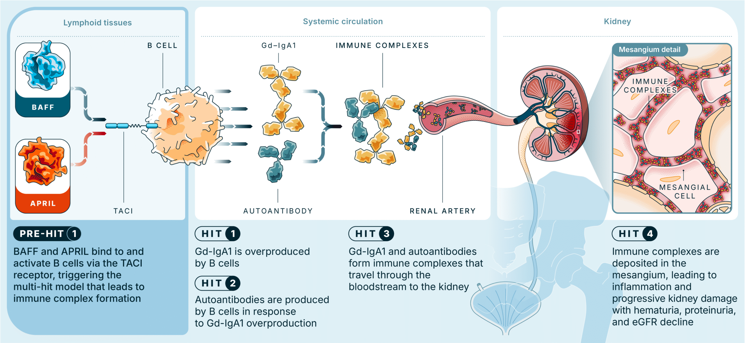 Illustrative mechanism of disease in IgAN