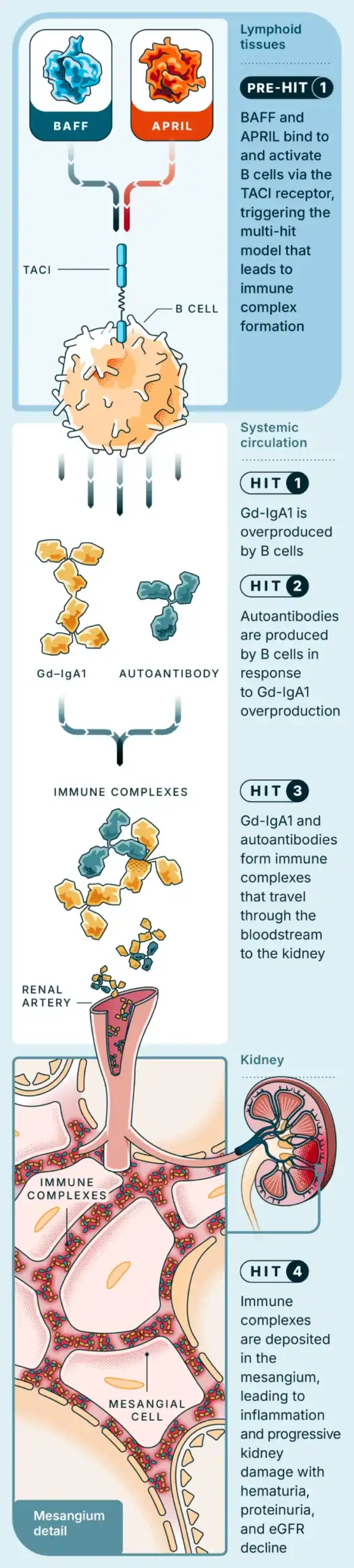 Illustrative mechanism of disease in IgAN